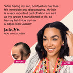 Viviscal Hair Growth Supplements For Women For Thicker, Fuller Hair 180 Tablets