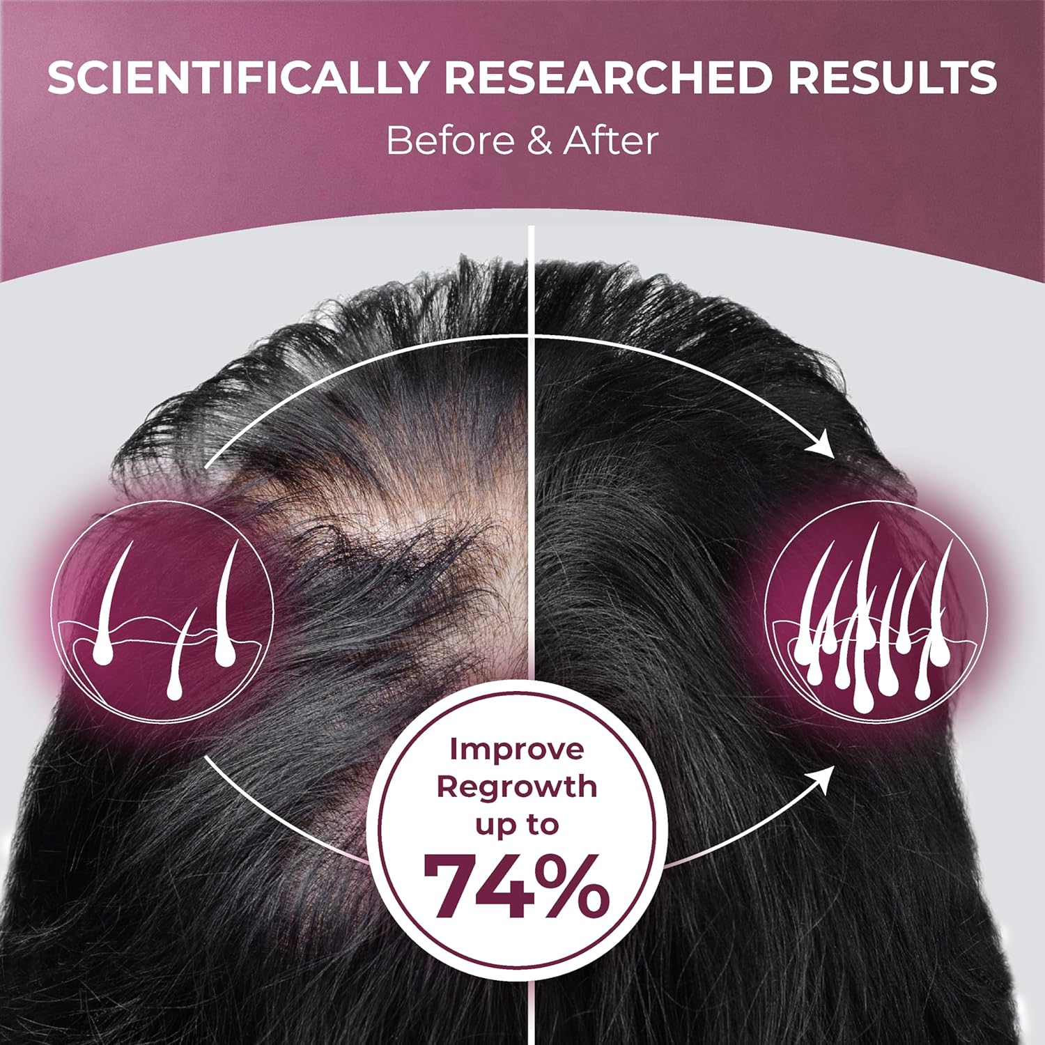 PUREHEALTH RESEARCH ReGrow - Hair Growth Vitamins - with Saw Palmetto, Biotin, Collagen, Zinc, Iron, Iodine, Selenium & More - Hair Supplements for Women & Men - 60 Capsules